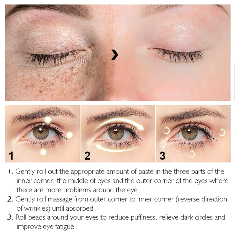 inner corner eye wrinkles