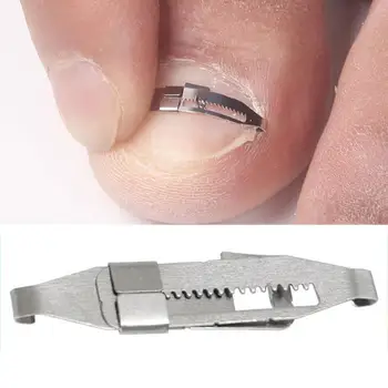 

Stainless Ingrown Toe Nail Fixer Pedicure Recover Embed Lifter Kit Tool Toenail Correction P1M2