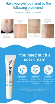 

1pcs Nuobisong facial scar removal Striae Gravidarum Pigmentation Corrector Anti-Aging cremas face Spots stretch marks massage
