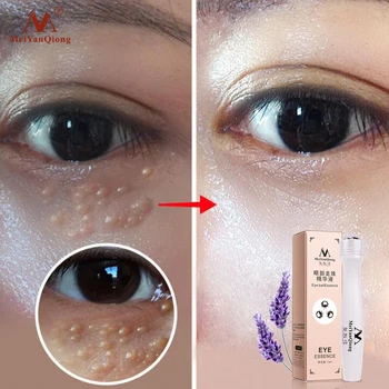 

Gold Anti-Puffiness Remove Wrinkles Skin Care Eye Cream Activating Eye Cream Dark Circle Anti-Aging Moisturizing Face Serum