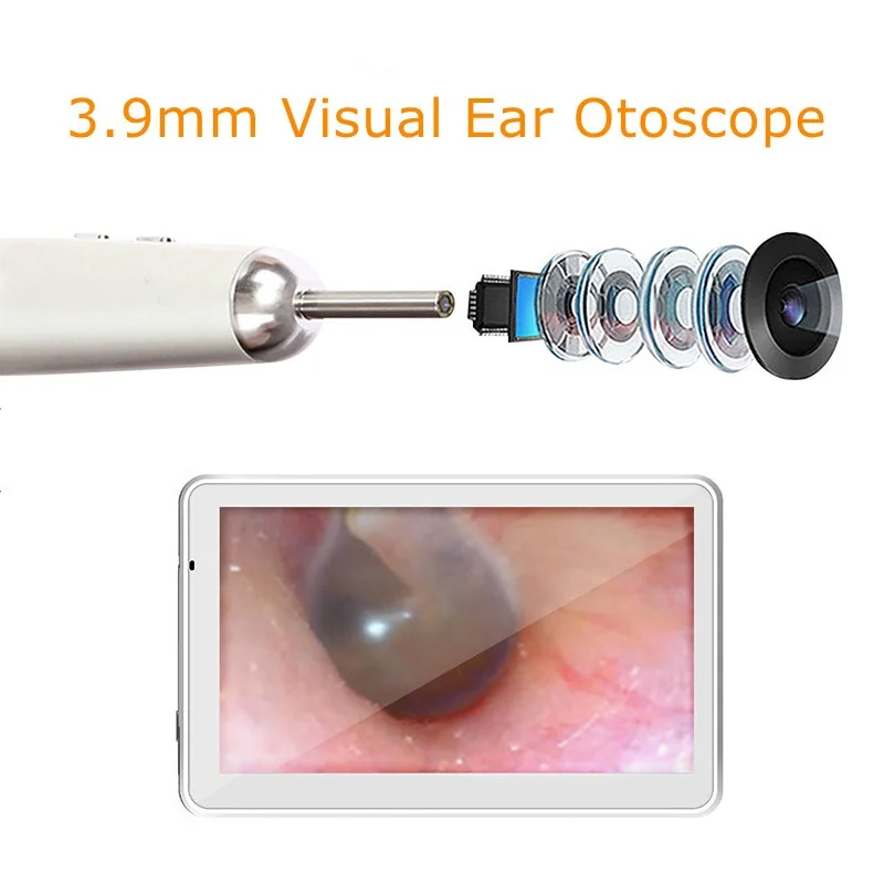 3.9MM Digital Otoscope 1080P Ear Cleaning Endoscope Earwax Cleaning