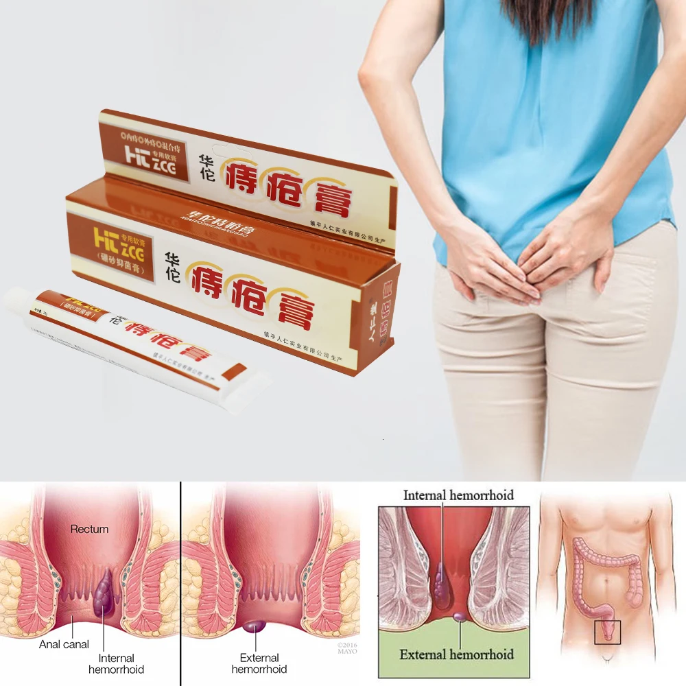 Hua Tuo Hemorrhoids Ointment Chinese Herbal Hemorrhoids Cream External Anal Fissure Medical Plaster Health Care Pain Relief