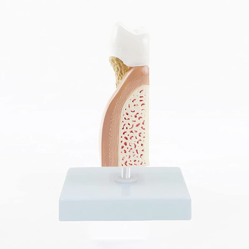 Tooth Pathological Disease Caries Medical Science Teaching Resources