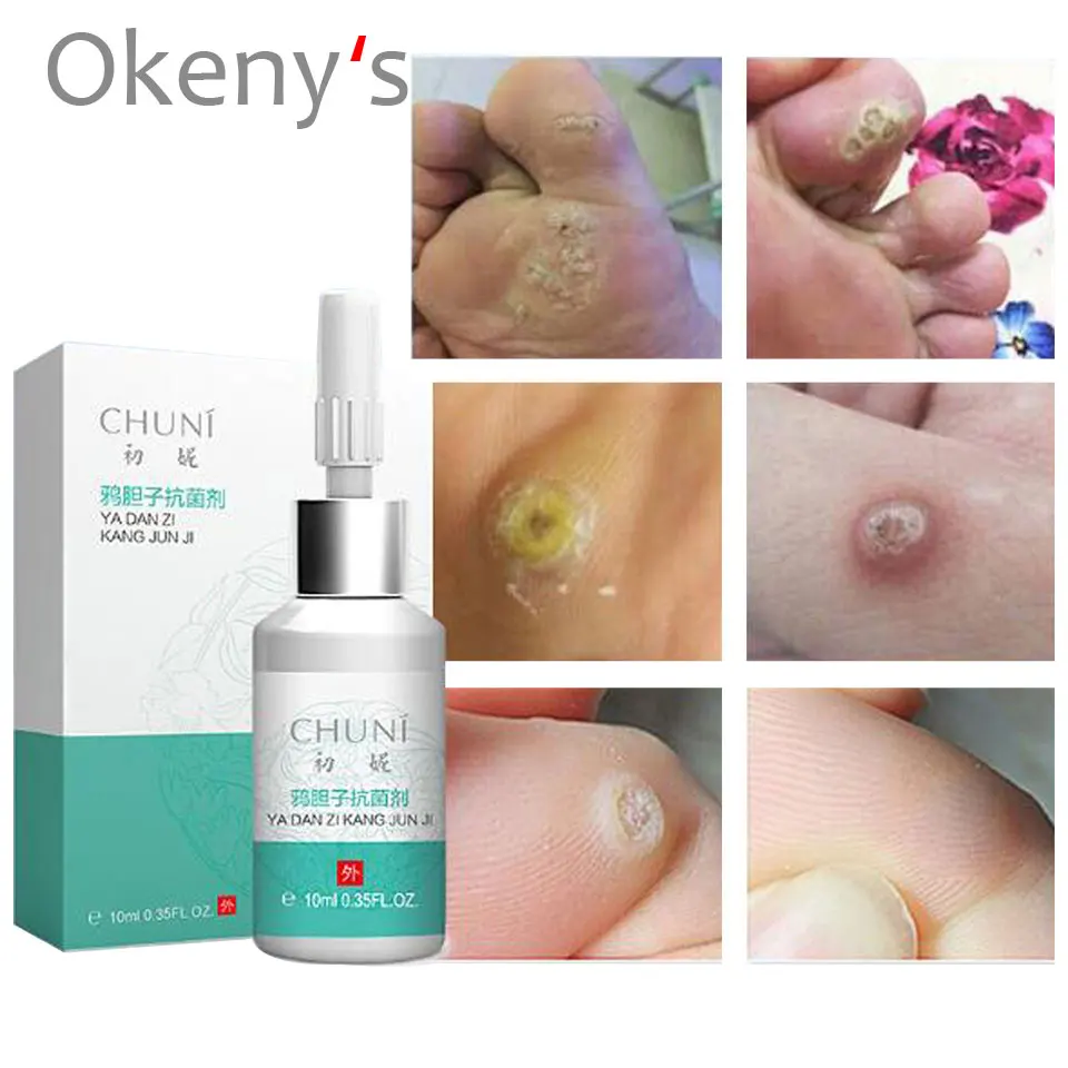 

Mole & Skin Tag Repair Solution Painless Mole Skin Dark Spot Repair Face Wart Tag Freckle Repair Cream Oil Dropshipping