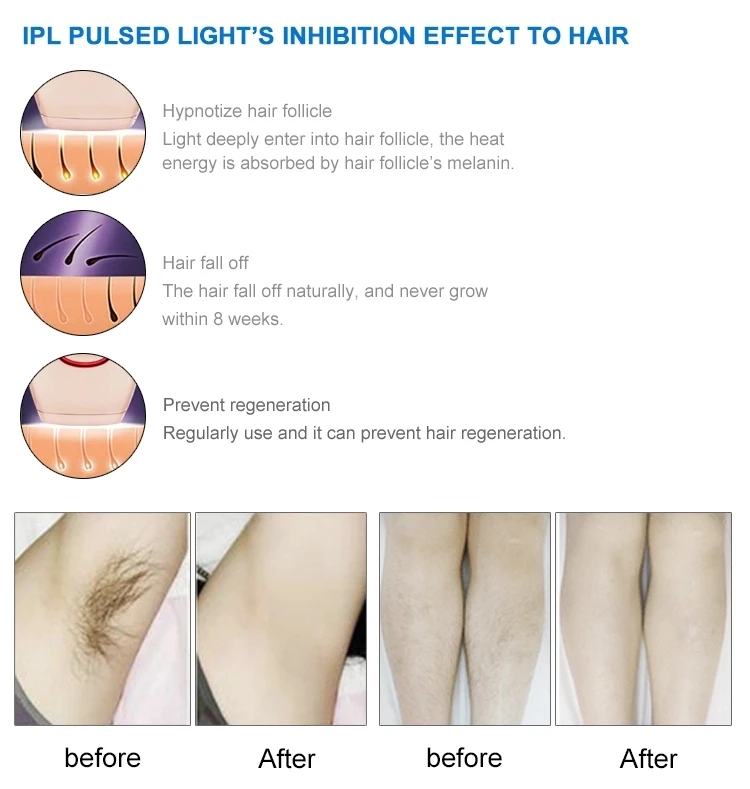 2019 новейшая машина для удаления волос с двойными ручками ipl opt ipl shr