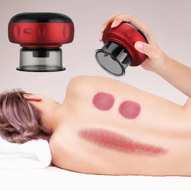Magnetic Therapy Body Scraping Wireless Gua Sha Vacuum Suction Cups Massage 1