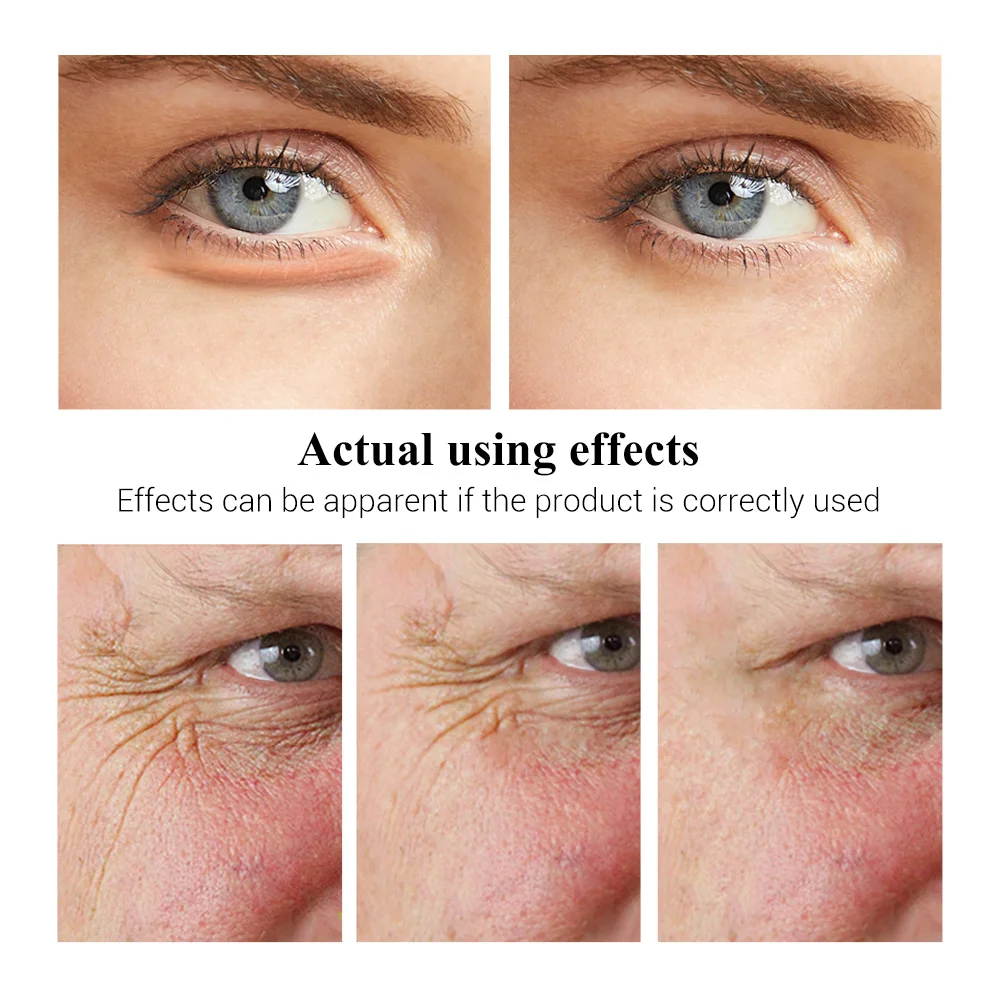 LANBENA Eye Cream Grape Seed Fading Fine Lines Dark Circle Removing Eye Puffiness Nourishing Moisturizing Firming 2