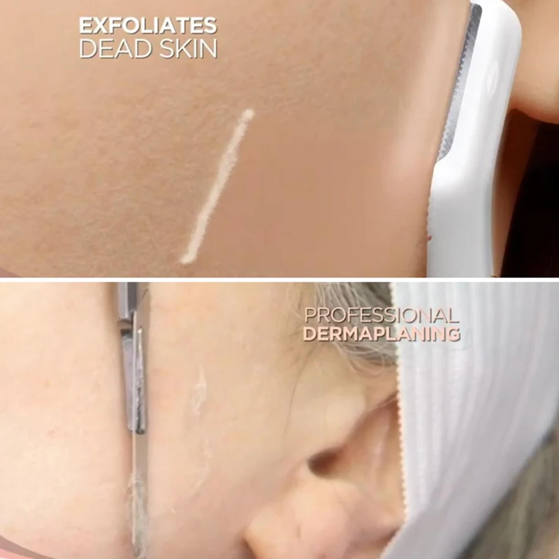Dermaplane средство для удаления волос с подсветкой, для лица, Expoliator, электрическая бритва Леди, бритва для лица, бритва для волос, безболезненная, Expoliates, мертвая кожа