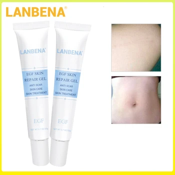 

2PCS LANBENA EGF Remover Scar Cream Stretch Mark Anti Acne Cream Acne Treatment Blackhead Whitening Skin Care Repair Face Cream