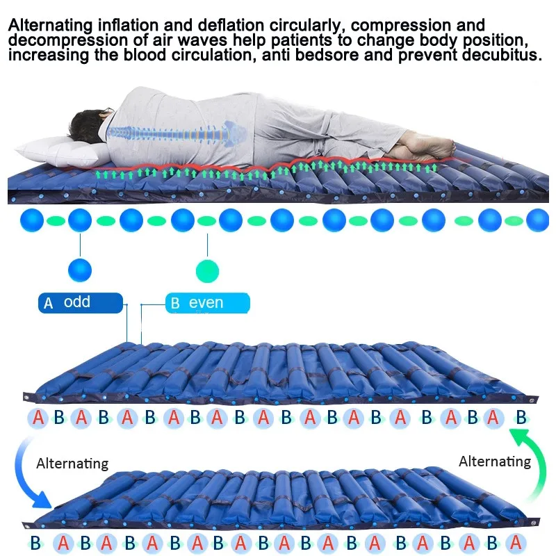 US $392.67 Medical Anti Bedsore Air Mattress Tubular Alternating Airflow Pressure Massage PVC Pad for elders Patients Home Hospital Bed