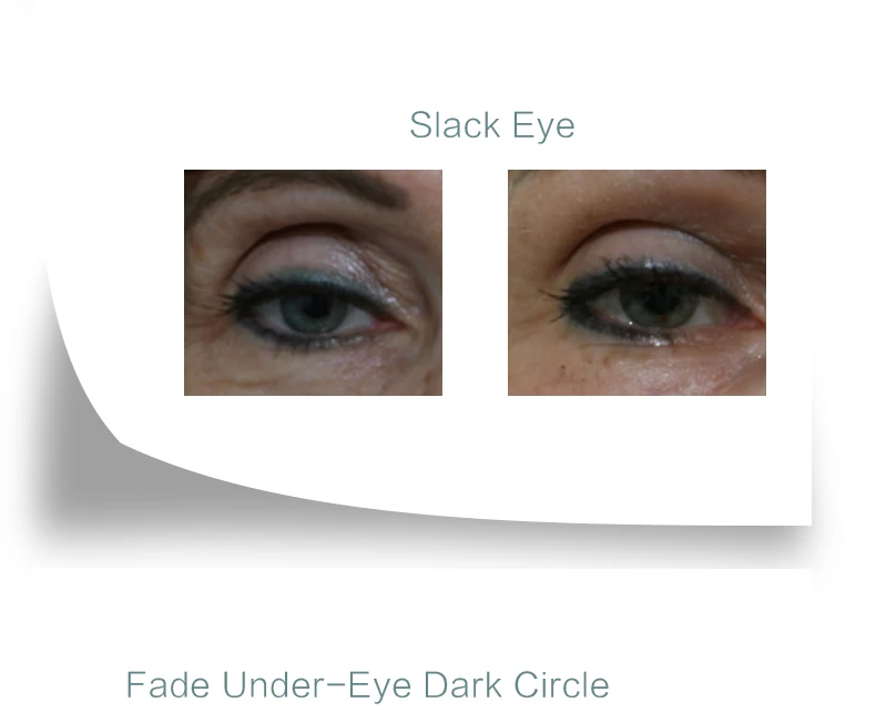 祛袋祛纹持久清润眼霜英文_07