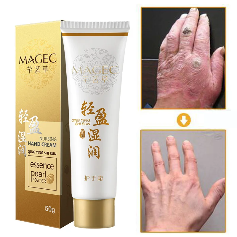 

WXE Nursing Hand Cream Effictive Moisturizes Hand Skin Hydration To Prevent Chapped