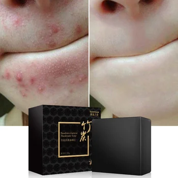 

Bamboo Charcoal Sea Salt Acne Treatments Handmade Soap Oil Control Mites Bacteria Removing Face Body Skin Deep Cleansing 100g Z1