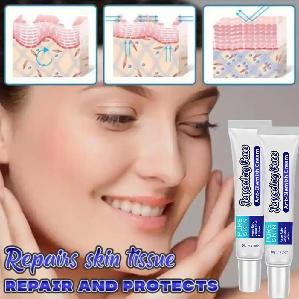 topical cream for stretch marks