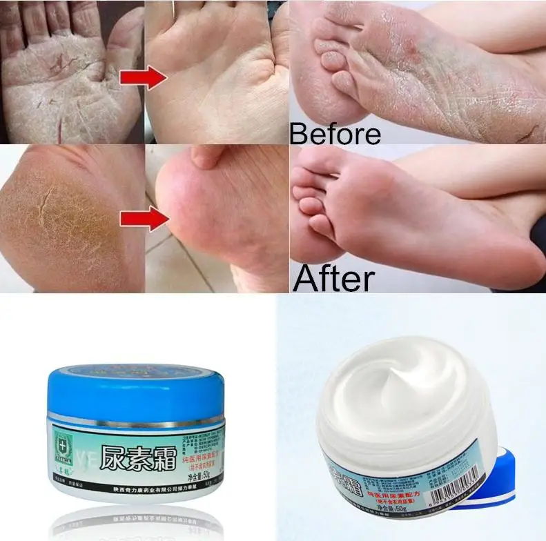 Original Urea Cream Repair Crystal Frost Hand And Foot Cream