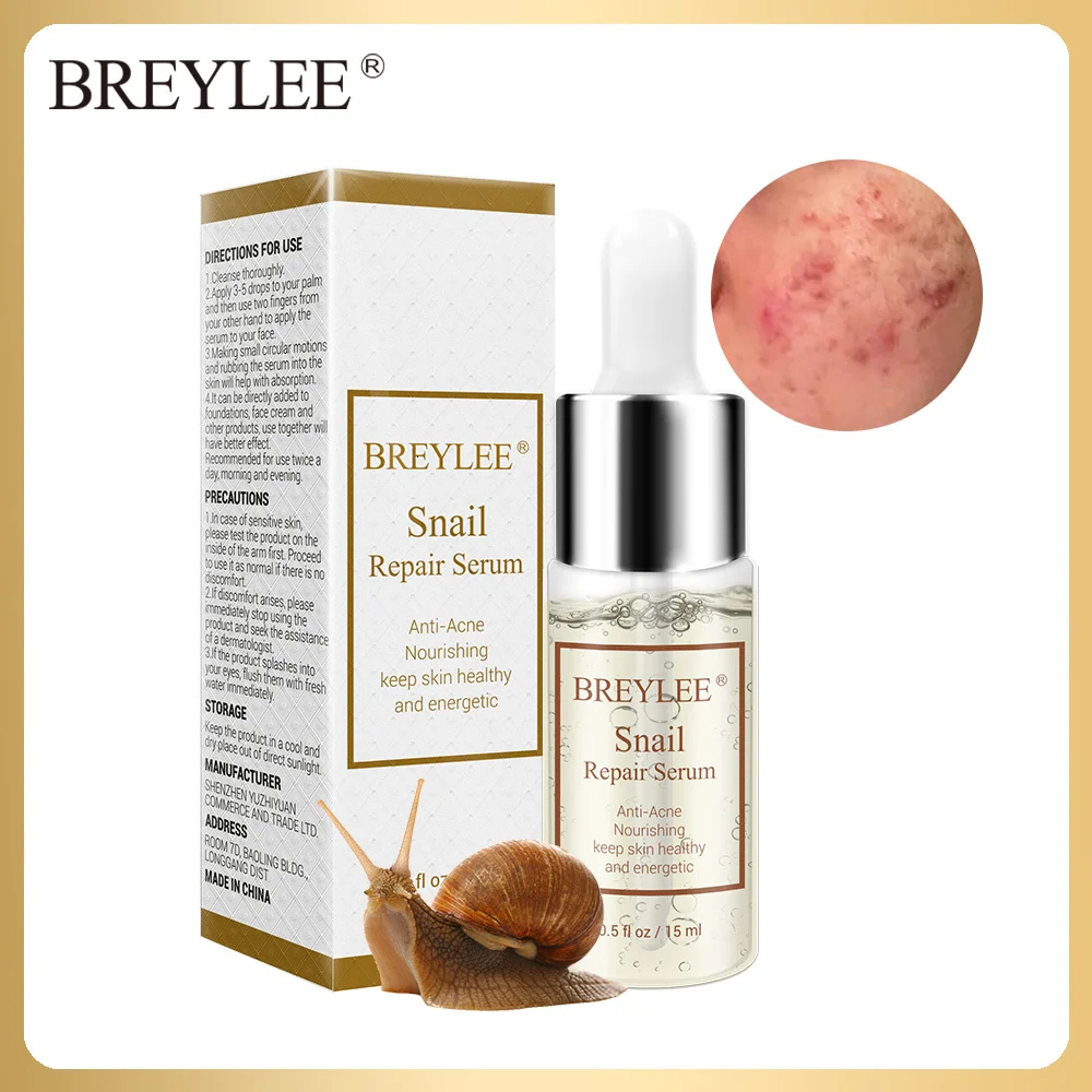 

BREYLEE Snail Repairing Serum Anti-Acne Rejuvenation Essence Scars Acne Treatment Liquid Face Skin Care Nourishing Moisturizing