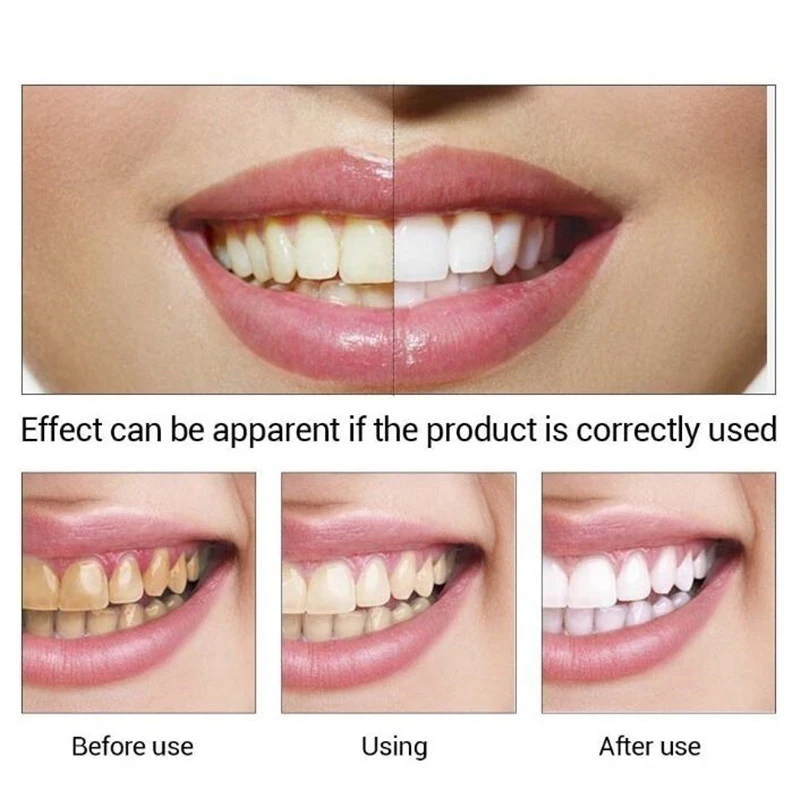 Tooth whitening tooth powder 100g, remove smoke stains, coffee stains, tea stains, freshen bad breath, oral hygiene, dental care