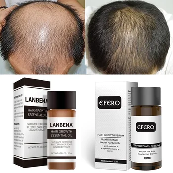 

Hair Growth Serum Prevent Hair Loss Fast Growth Essence Natural Hair Growing Serum Restoration Essence Thicken Hair Care