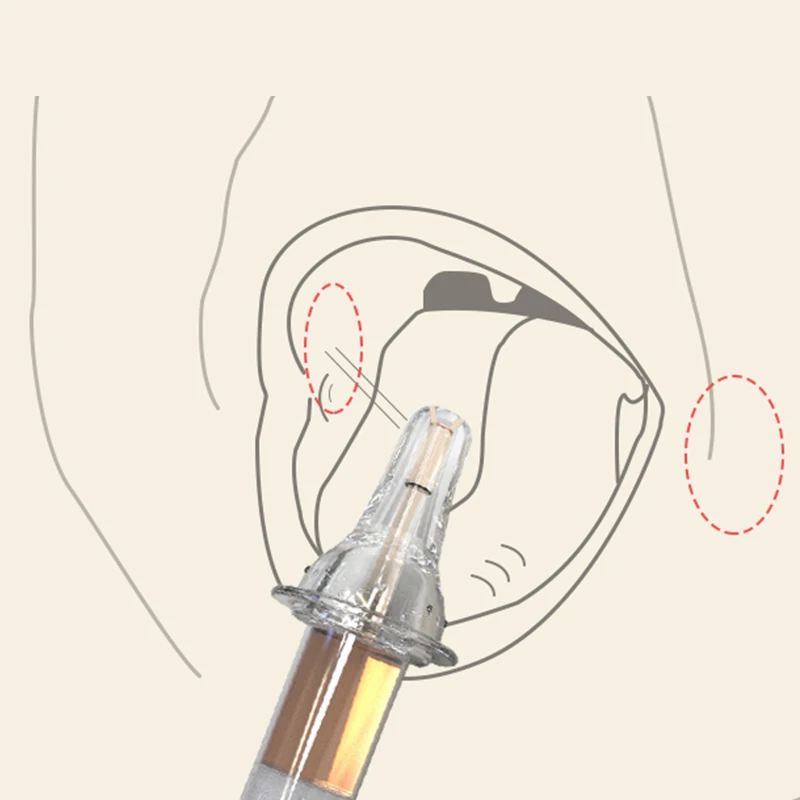 Baby Silicone Drug Feeder Syringe Type Mills Nipple Medicine Feeder On Both Sides Of The Liquid Feeding Device Baby Food Mills