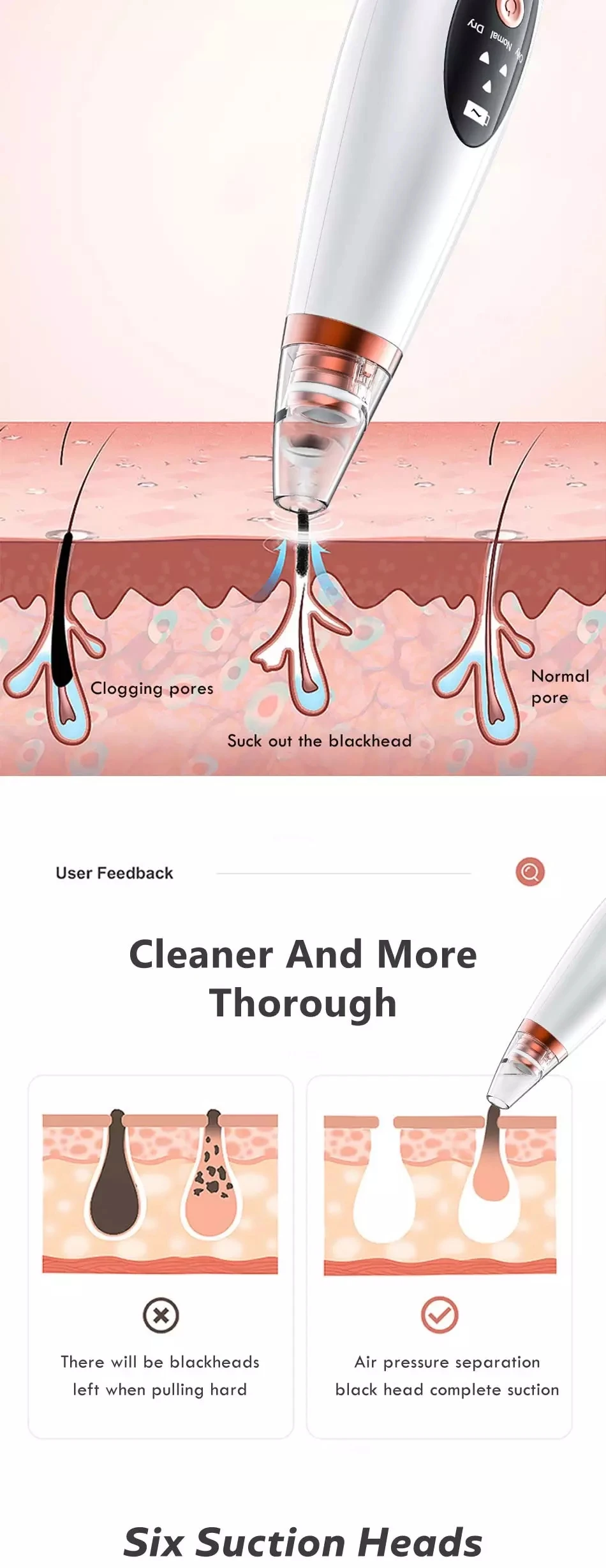 blackhead remover 8.webp