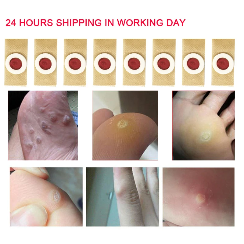 16Pcs Foot Care Sticker Medical Patch Corn Removal Pads Warts Thorn Curative Patches Calluses Remove Callosity Detox
