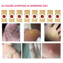 16Pcs Foot Care Sticker Medical Patch Corn Removal Pads Warts Thorn Curative Patches Calluses Remove Callosity Detox