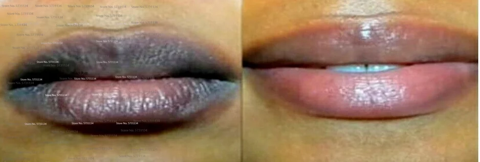 Lip care Of Lips Pink Fresh Lightening Bleaching Cream Treatment Remove Dark Smoke Lips lip oil 5
