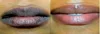 Lip care Of Lips Pink Fresh Lightening Bleaching Cream Treatment Remove Dark Smoke Lips lip oil 5