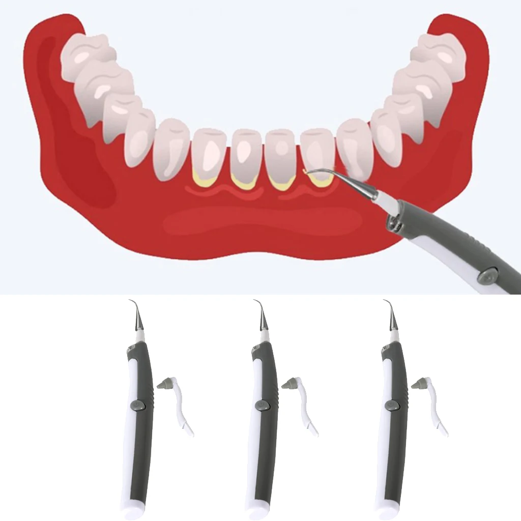 3x Electric Tooth Cleaner Stain Removal Scaler Tool Teeth Cleaning Oral Care 3x Electric Tooth Cleaner Stain Removal Scaler Tool Teeth Cleaning Oral Care