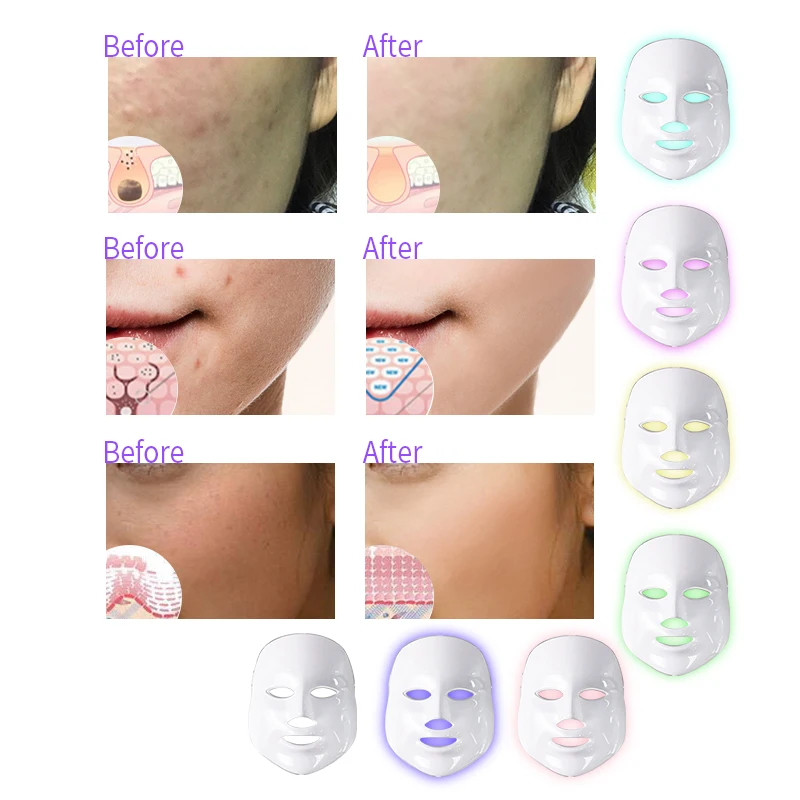 Online 7 colores Led máscara Facial belleza cuidado de la piel rejuvenecimiento arrugas eliminación de acné Facial terapia de belleza blanqueamiento instrumento de ajuste