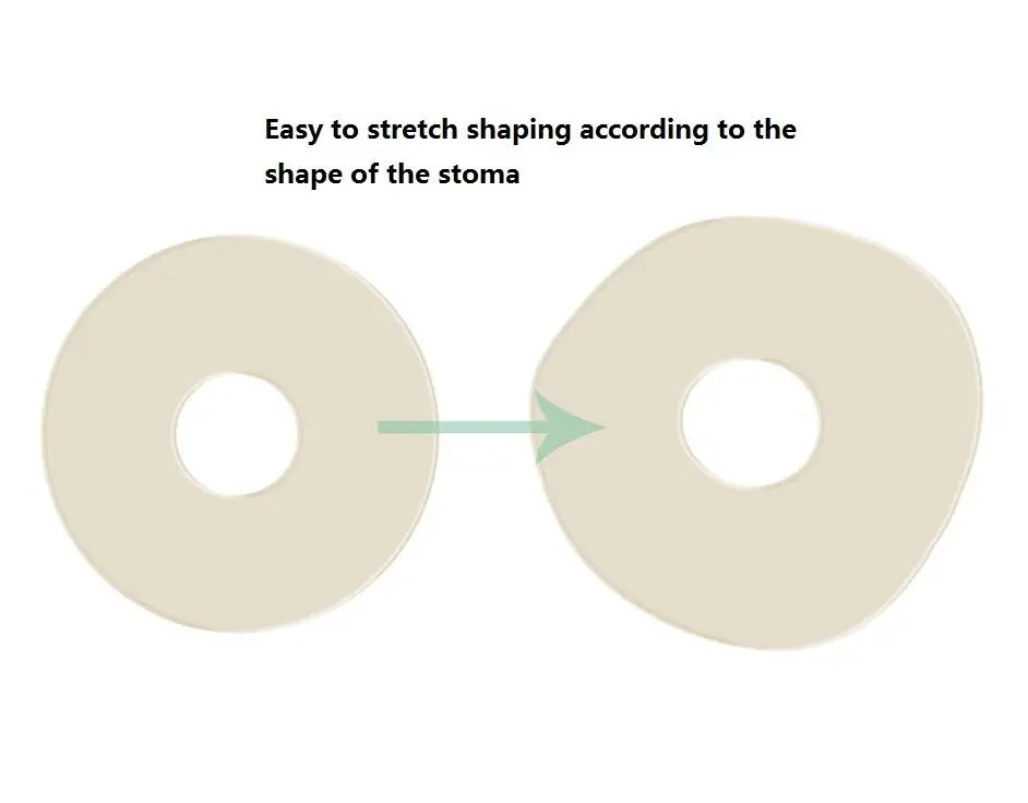 10 шт. кольцо с остомической пастой, растягивающееся, чтобы предотвратить утечку, герметичное кольцо с остомической пастой для защиты кожи, Новое поступление