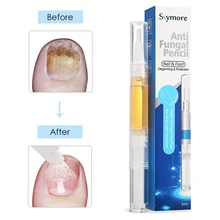 Ногти для ног "францзуский маникюр" грибок Лечение грибка ногтей гель с пилочка для ногтей лечения Ногтей решение гель для онихомикоз макияж