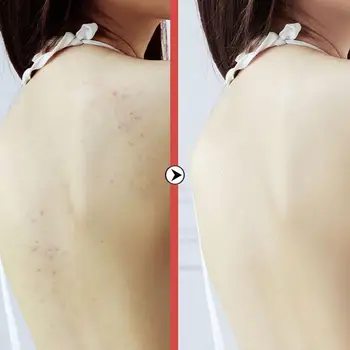 

50ml Chamomile Essence Natural Essential Moisturizing Remove Pores Massage Cream Smooth Soften Bumps Goose Oil Shrink I0W1