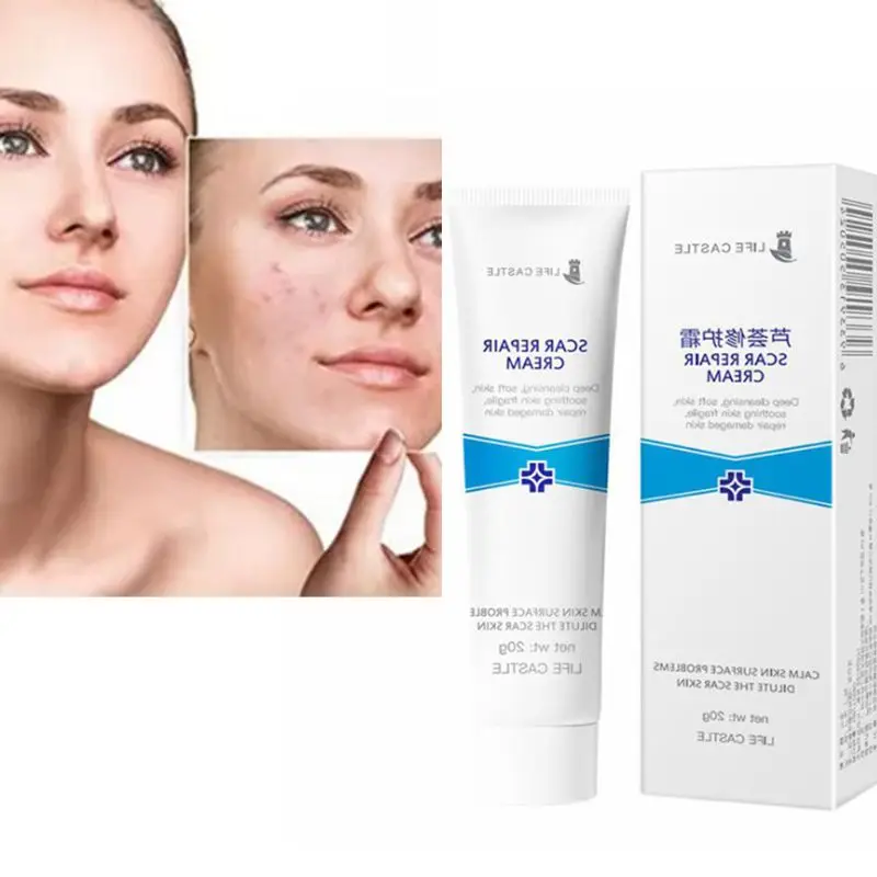 

20g Scar Repair Cream Face Acne Stretch Marks Removal Treatment Whitening Paste Q0KD