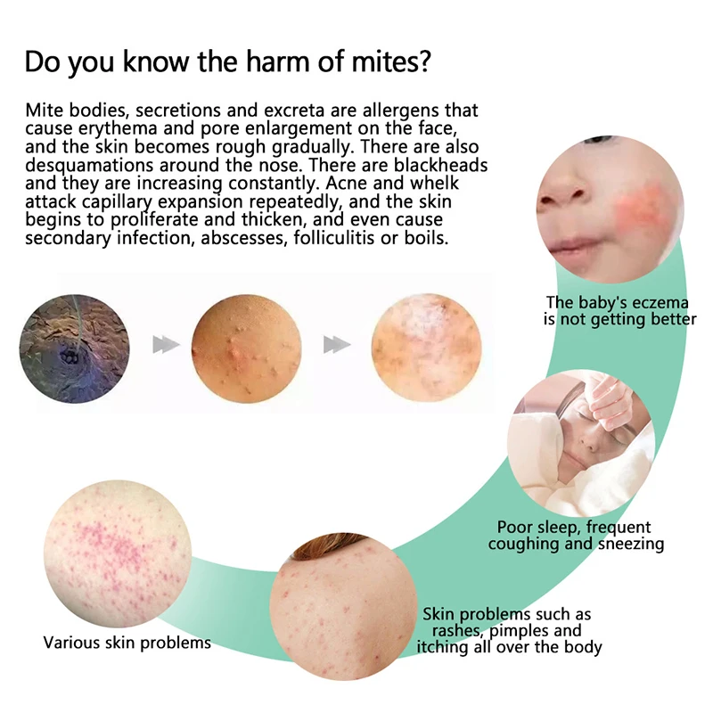 Mite Killer Spray Or Herbal Mite Removal Package Bed Bugs Removal Home Use Cleaning Natural Herbal Bedroom Mite Killer