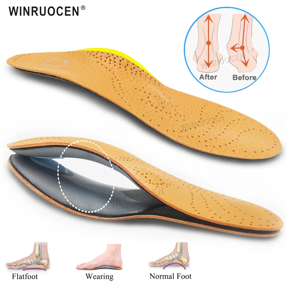 男性と女性のための扁平足の中敷き アーチサポート Ox Legパッド付きの革製整形外科用インソール インソール Aliexpress