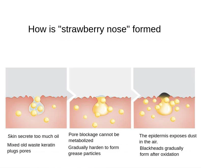Aspirador de pó Remoção da Pele Poros Acne Espinha Máquina Aperto Zona Nariz Preto Cabeça Extrator Encolhimento Dermabrasion Beleza 8 Utensílios de cuidado facial