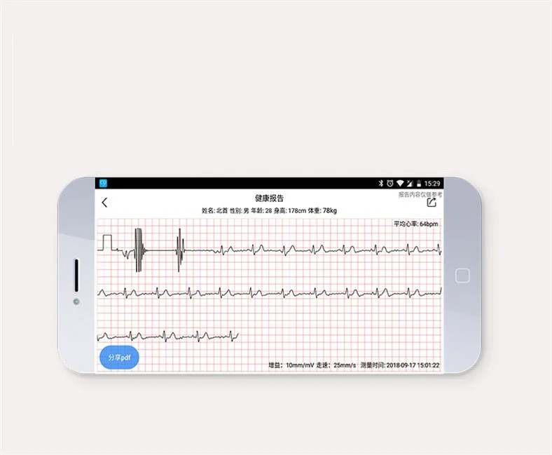 Смарт-часы IP68 Водонепроницаемые умные часы ECG+ PPG Dual Heart Rate HRV шаг спорт на открытом воздухе часы мониторинга для мужчин и женщин носимые