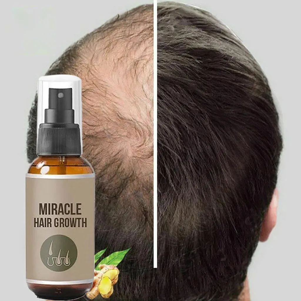 30 мл/50 мл спрей для роста бороды Имбирная эссенция спрей эффективный экстракт от выпадения волос питает корни для мужчин рост волос# a