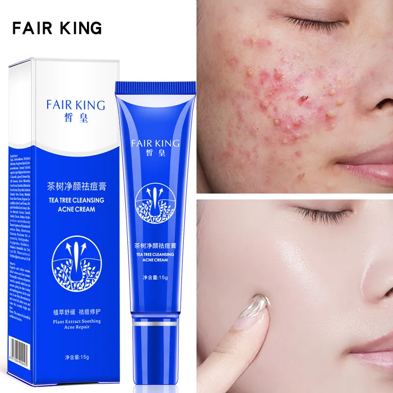

Acne Treatment Face Cream Remove Acne Scar Mark Whitening Oil Control Shrink Pores Cream Blackhead Repair Cleaning Skin Care