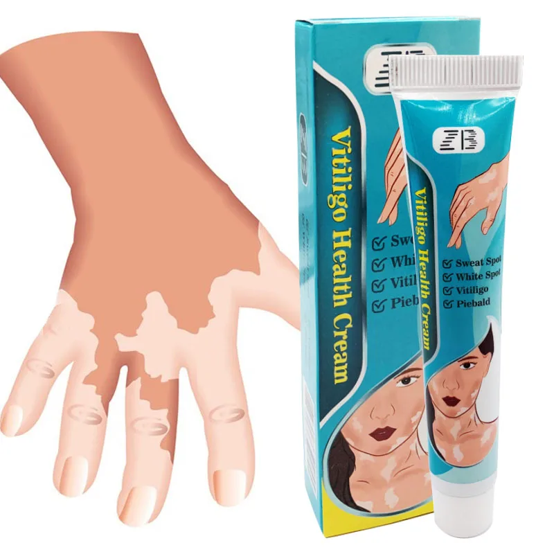 ZB Vitiligo Treatment Cream Sweat Spot Piebald Remove Herbal Medicine Plaster Versicolor Pityriasis Eczma Cure Skin Care Balm | Красота и