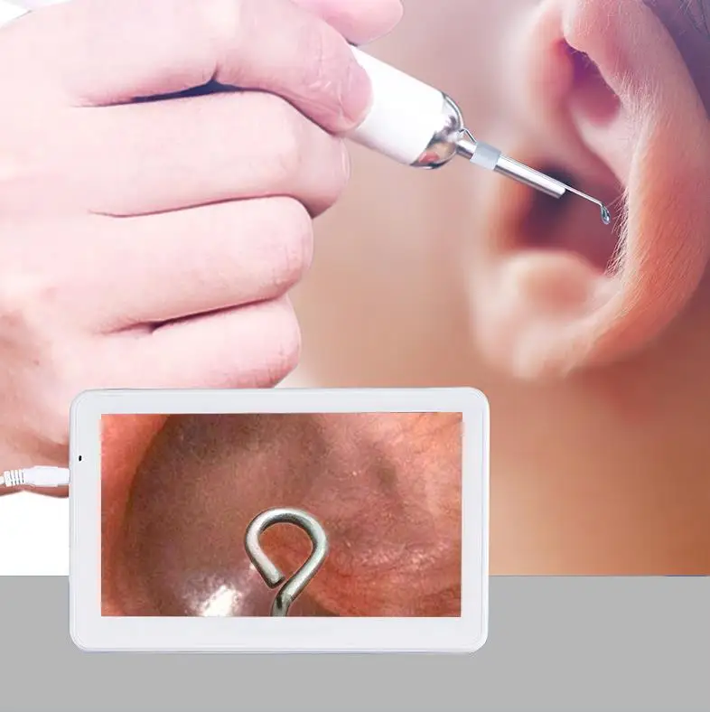 Otoscope 7.0Inches Screen HD Visual Ear Cleaner Endoscope Earpick Nose Camera Digital Ophthalmoscop