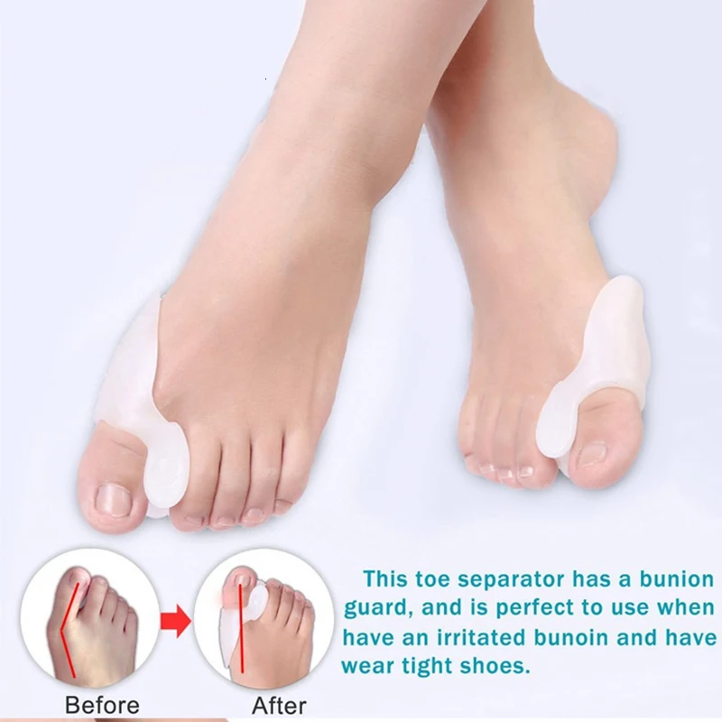 7 шт./компл. Bunion гелевый корректор прокладка стрейч нейлон Hallux Valgus протектор Защита носок Сепаратор ортопедические поставки Уход за ногами инструмент