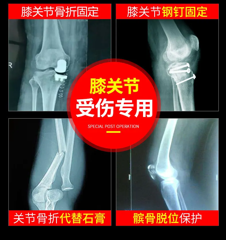 Регулируемый фиксатор колена держатель нижней конечности Meniscus реабилитация колено картридж ноги перелом защитная одежда защита