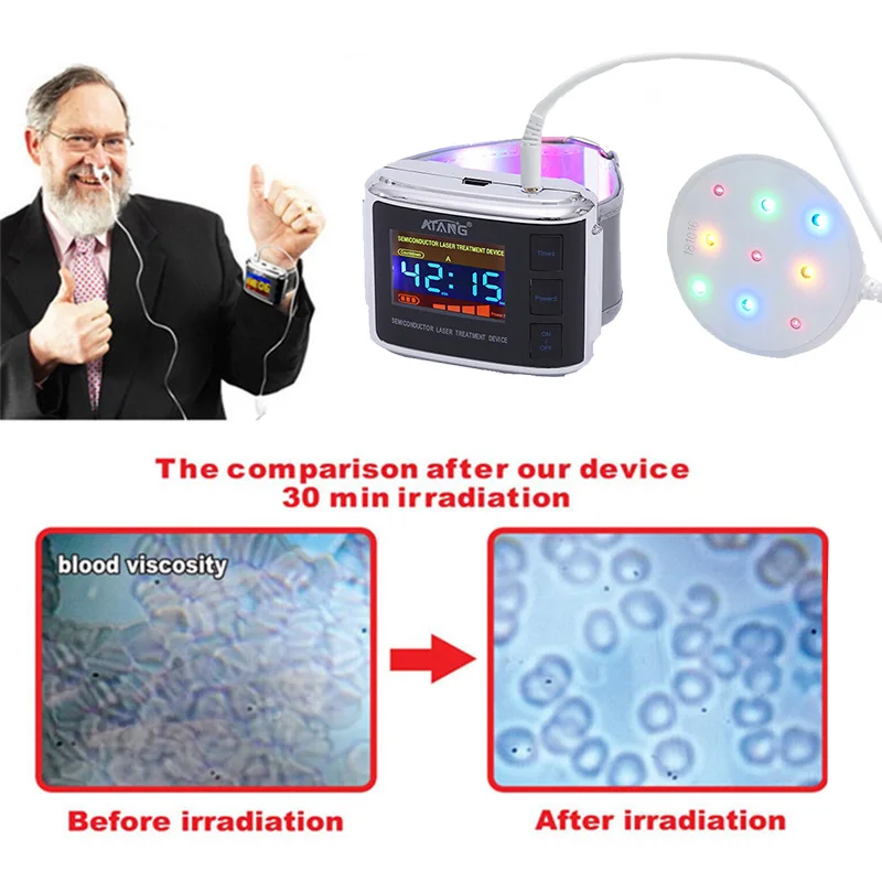 

Health Care Laser Light physiotherapy Watch for Lowering Blood Viscosity Preventing Formation of Thrombus