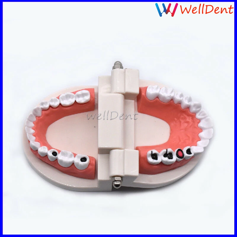 Dental-Study-Teaching-Teeth-Model-Caries-Tooth-Care-_57 (2)