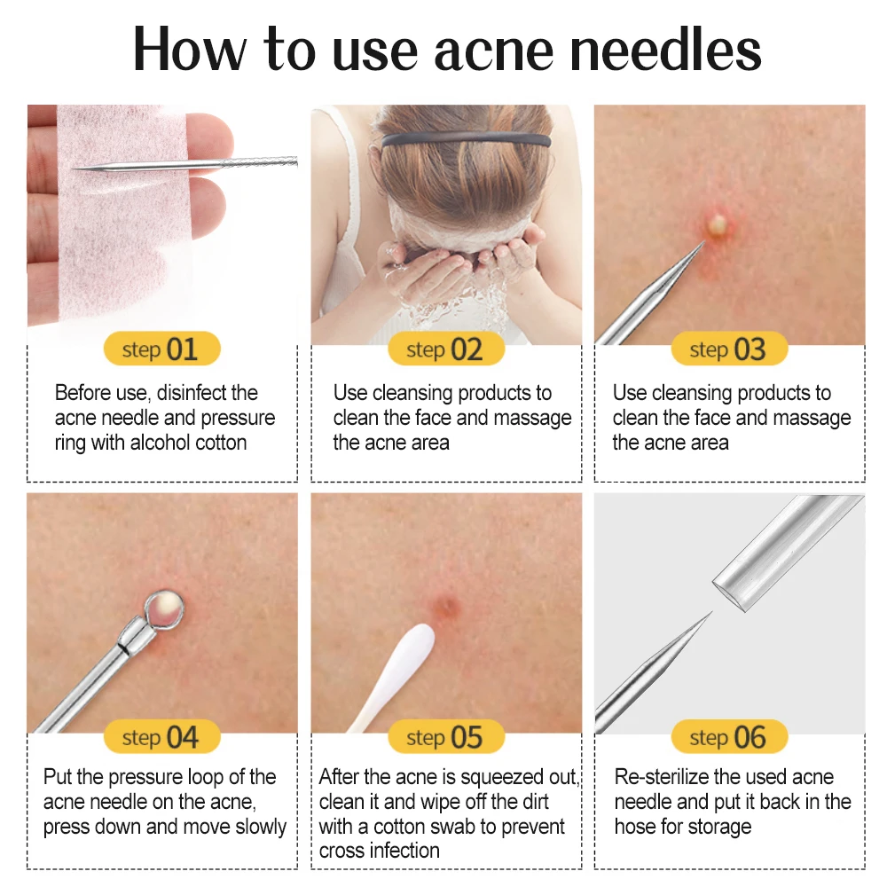 Acne, Blackhead, Pore, Black Dots Removal Needles 6