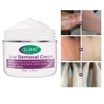 

Skin Rebound Scarless Cream Scar Removal Cream Face Cream For Face Acne Scar Stretch Marks Skin Repair Face Cream