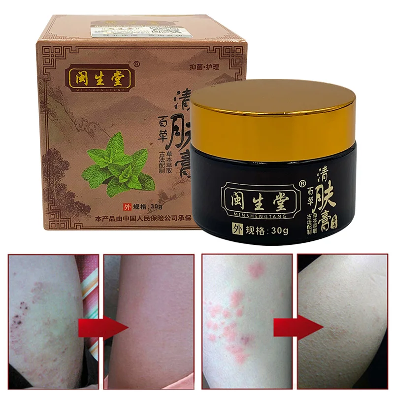 

Best Cleansing Cream Herbal Essence Skin Care Antibacterial Itching Ointment Removes Eczema Skin Allergy QQ99