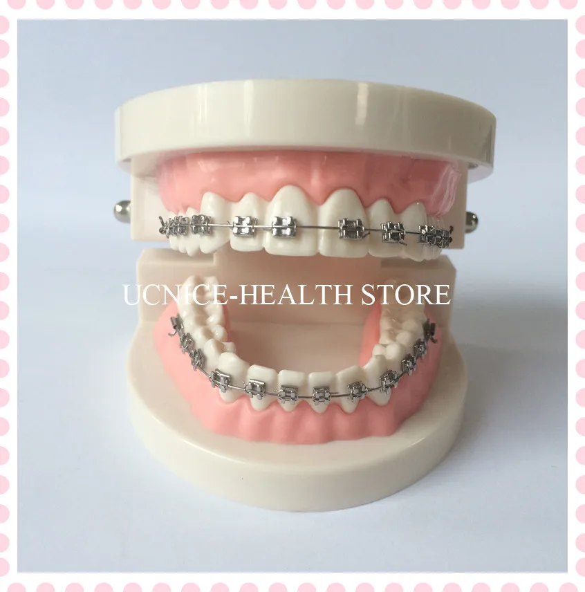 Orthodontic teeth model-1